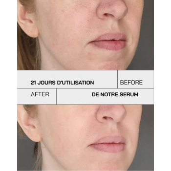 Touché Vitamine C 11% Booster D’éclat 30 ml