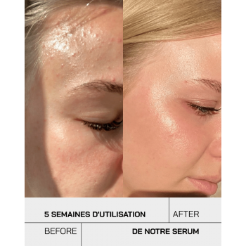 Touché Niacinamide 10% + Zinc 1% 30 ml